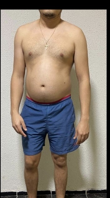 Transformação de definição muscular - antes